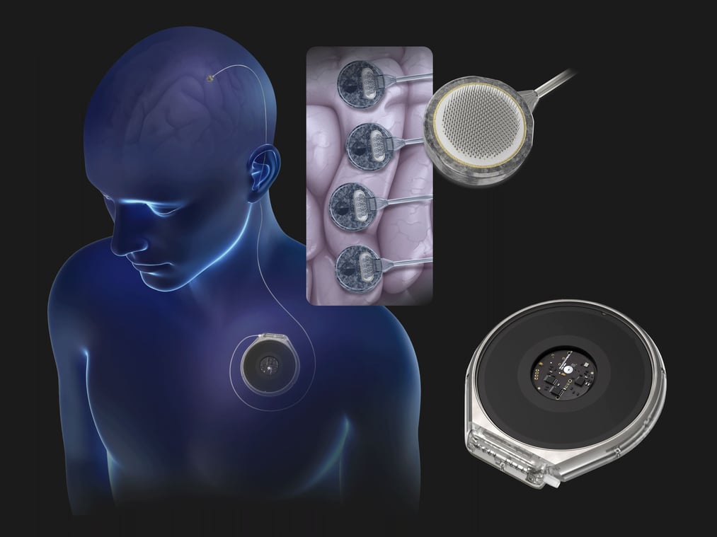 Paradromics prepares to conduct human trials for its brain implant technology.