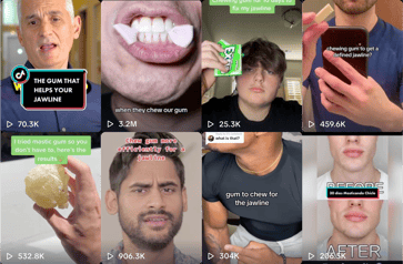 Dentists warn that using hard gum to chisel jawlines may do more harm than good for Gen Z boys.