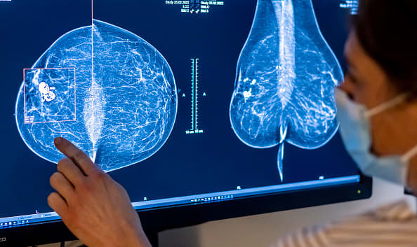 Cancer's financial toll is increasing, but here are ways to mitigate it.