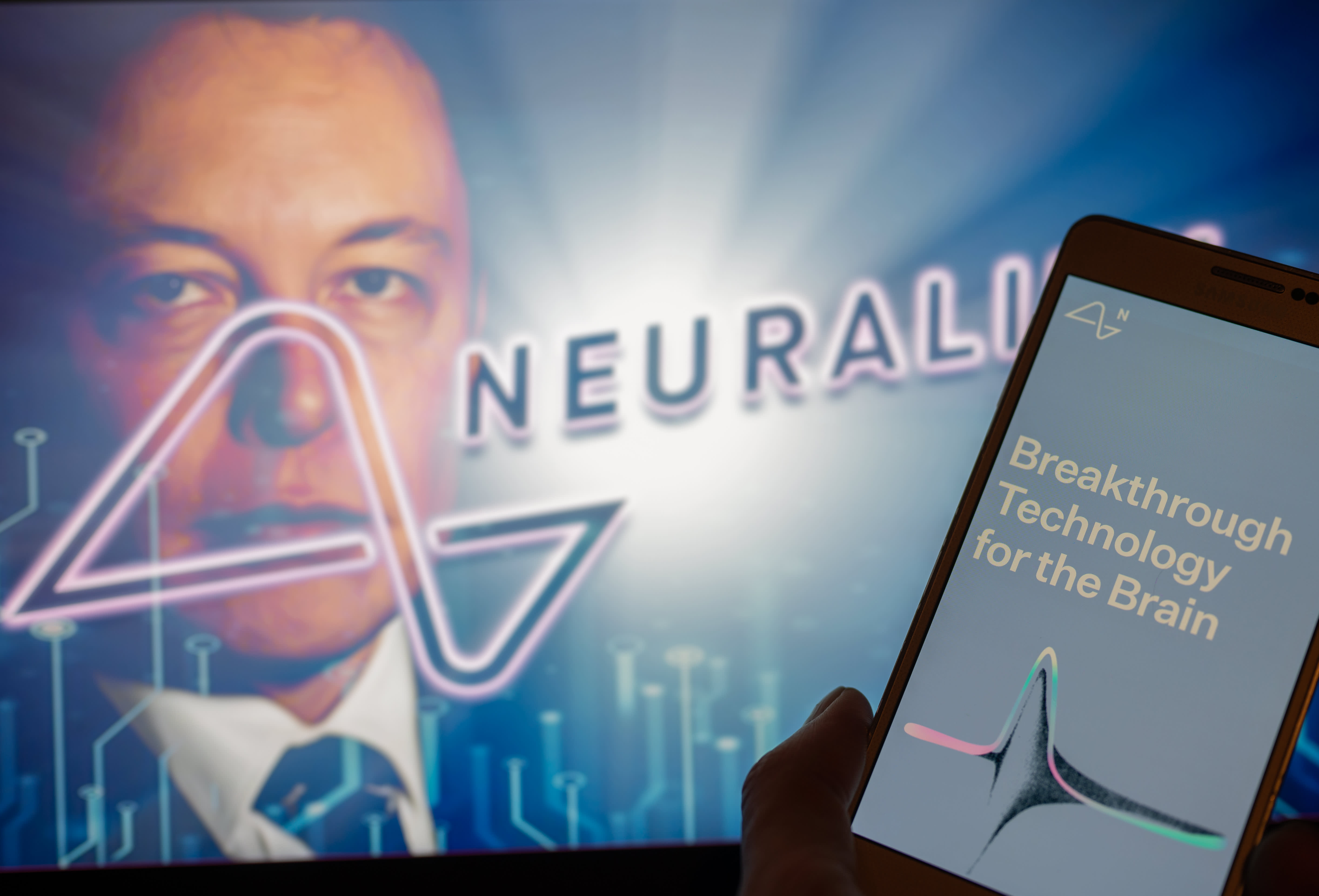 Despite challenges with the first patient, Musk predicts the next Neuralink brain implant will be released soon.